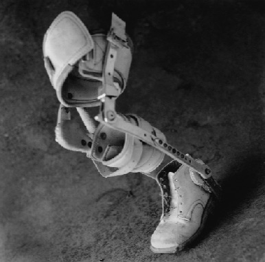 BABY LEGBRACE